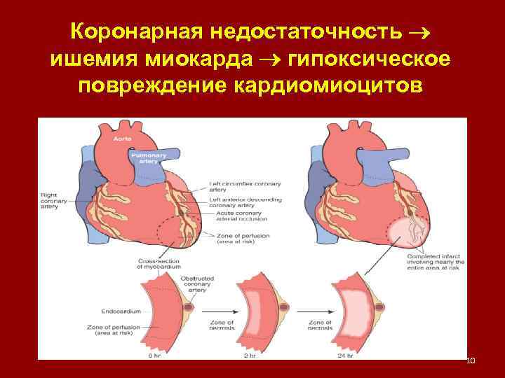 Разрывы сердца понятие патогенез клиническая картина диагностика и принципы лечения