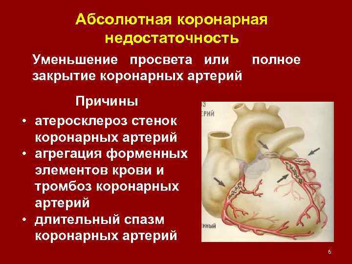Абсолютная коронарная недостаточность Уменьшение просвета или полное закрытие коронарных артерий Причины • атеросклероз стенок