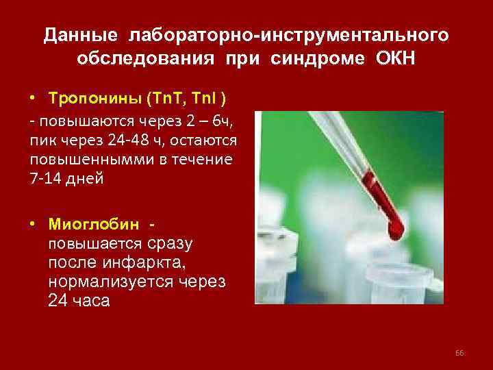 Данные лабораторно-инструментального обследования при синдроме ОКН • Тропонины (Tn. T, Tn. I ) -