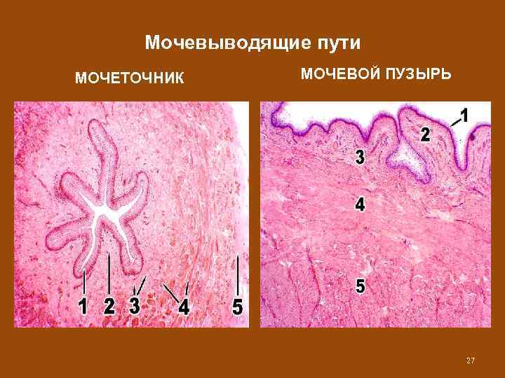 Строение стенки мочевыводящих путей