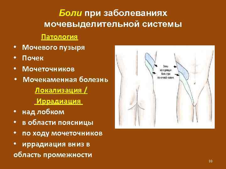 Боли при заболеваниях мочевыделительной системы Патология • Мочевого пузыря • Почек • Мочеточников •