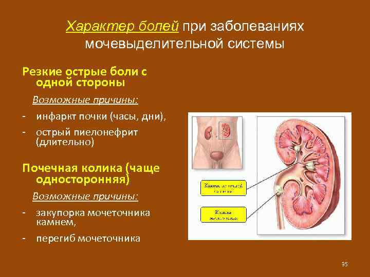 Заболевания мочевыделительной системы. Заболевания при мочевыделительной системы. Симптомы заболеваний мочевыделительной системы. Симптомы патологии мочевыделительной системы.