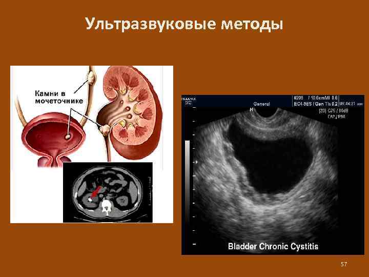 Ультразвуковые методы 57 