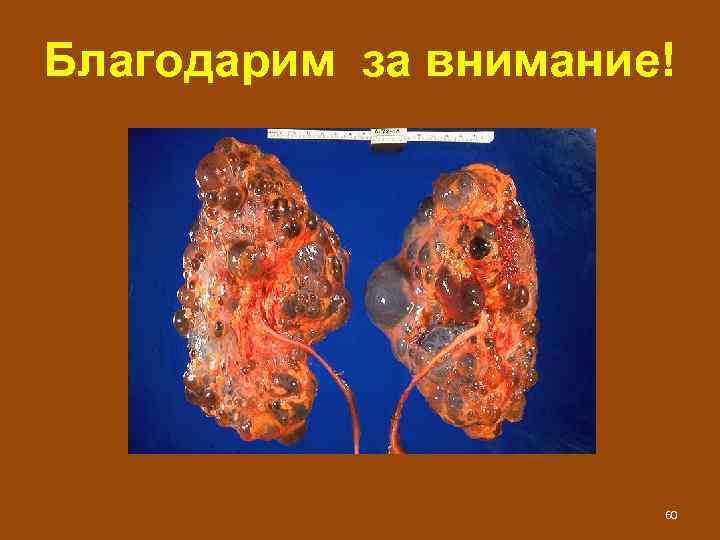 Благодарим за внимание! 60 