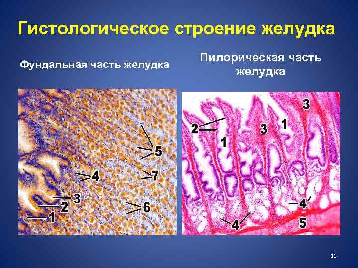 Гистологическое строение желудка Фундальная часть желудка Пилорическая часть желудка 12 