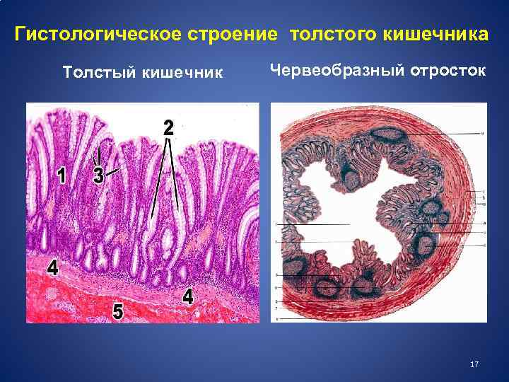 Гистологическое строение толстого кишечника Толстый кишечник Червеобразный отросток 17 