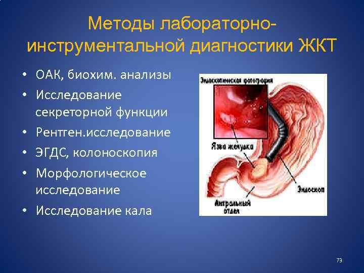 Методы лабораторноинструментальной диагностики ЖКТ • ОАК, биохим. анализы • Исследование секреторной функции • Рентген.