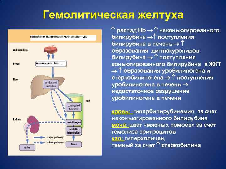 Гемолитическая желтуха распад Hb неконьюгированного билирубина поступления билирубина в печень образования диглюкуронидов билирубина поступления
