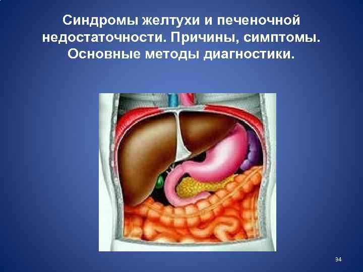 Синдромы желтухи и печеночной недостаточности. Причины, симптомы. Основные методы диагностики. 34 