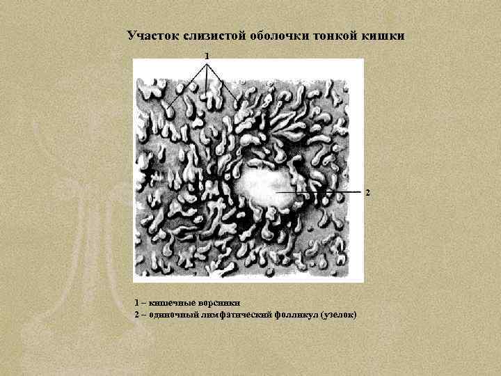 Участок слизистой оболочки тонкой кишки 1 2 1 – кишечные ворсинки 2 – одиночный