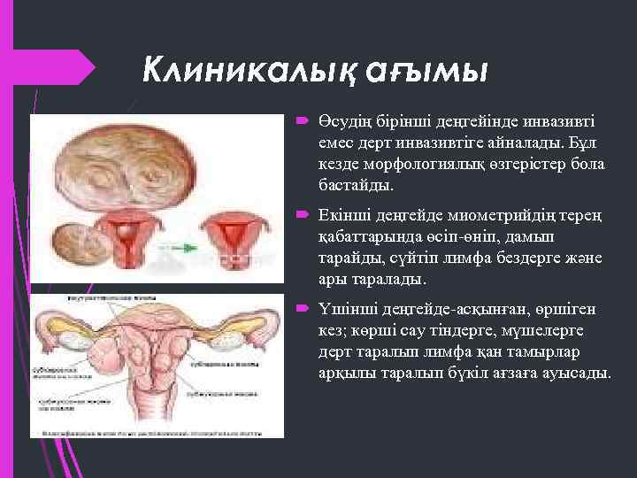 Клиникалық ағымы Өсудің бірінші деңгейінде инвазивті емес дерт инвазивтіге айналады. Бұл кезде морфологиялық өзгерістер