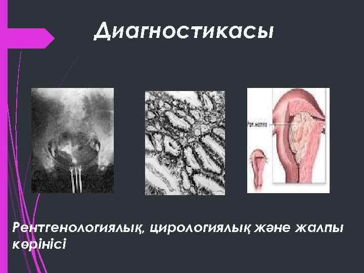 Диагностикасы Рентгенологиялық, цирологиялық және жалпы көрінісі 
