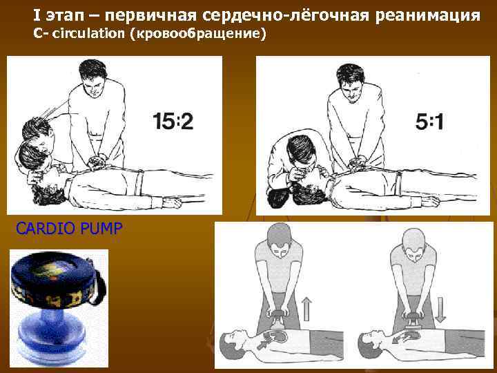 I этап – первичная сердечно-лёгочная реанимация C- circulation (кровообращение) CARDIO PUMP 