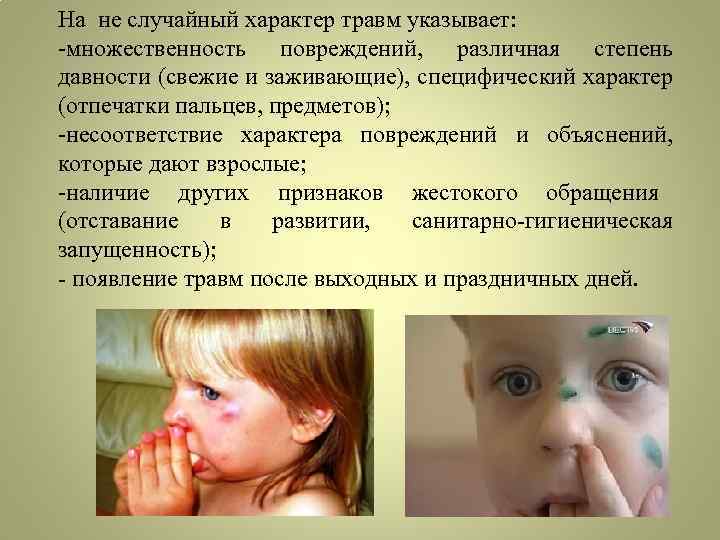 На не случайный характер травм указывает: -множественность повреждений, различная степень давности (свежие и заживающие),