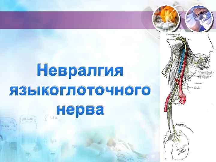 Невралгия языкоглоточного нерва 