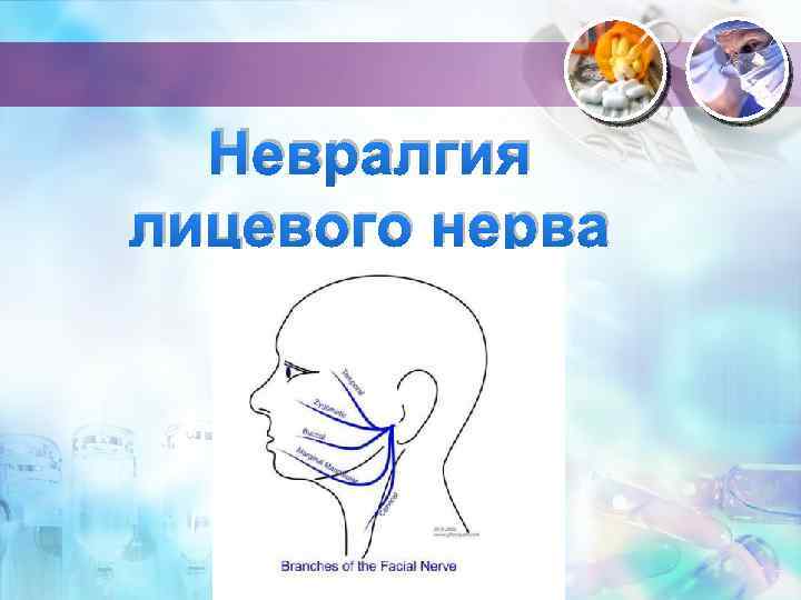 Невралгия лицевого нерва 