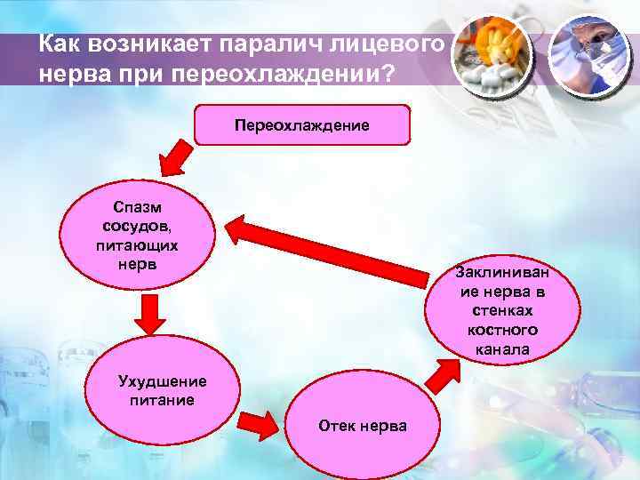 Как возникает паралич лицевого нерва при переохлаждении? Переохлаждение Спазм сосудов, питающих нерв Заклиниван ие