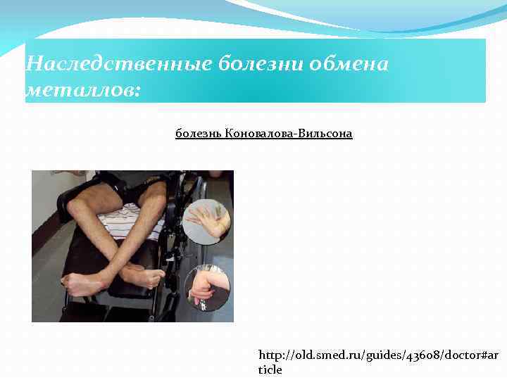 Наследственные болезни обмена металлов: болезнь Коновалова-Вильсона http: //old. smed. ru/guides/43608/doctor#ar ticle 