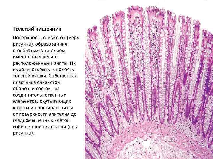 Толстый кишечник Поверхность слизистой (верх рисунка), образованная столбчатым эпителием, имеет параллельно расположенные крипты. Их