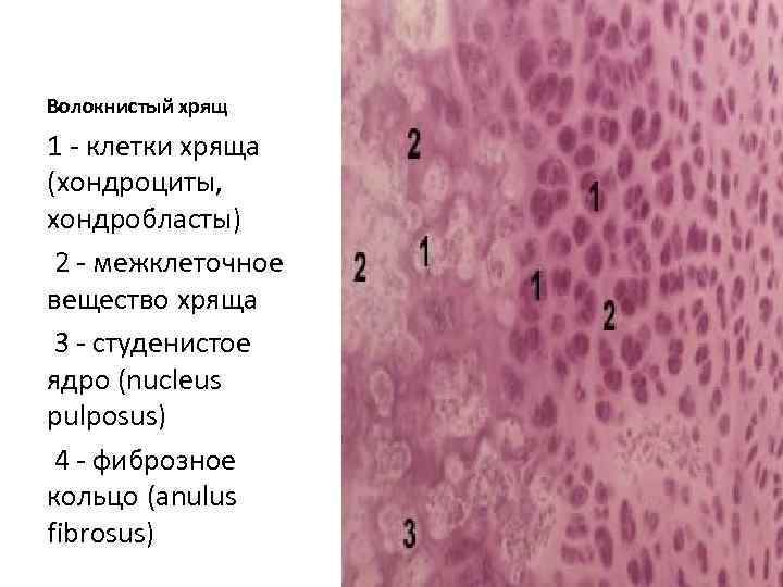 Волокнистый хрящ рисунок