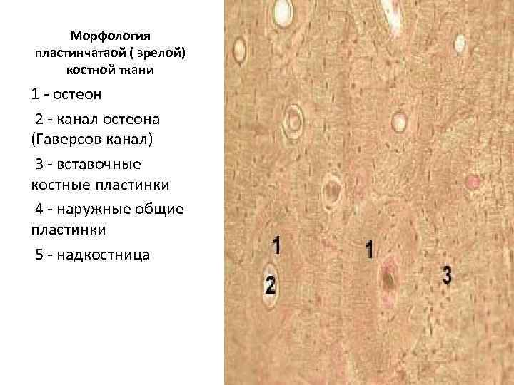 Морфология пластинчатаой ( зрелой) костной ткани 1 - остеон 2 - канал остеона (Гаверсов