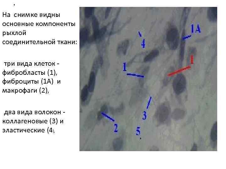 . На снимке видны основные компоненты рыхлой соединительной ткани: три вида клеток фибробласты (1),