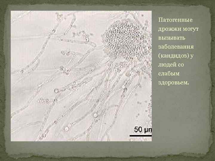 Патогенные дрожжи могут вызывать заболевания (кандидоз) у людей со слабым здоровьем. 