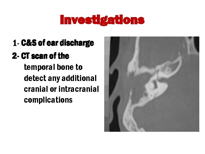 Investigations 1 - C&S of ear discharge 2 - CT scan of the temporal