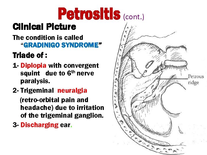 Petrositis (cont. ) Clinical Picture The condition is called “GRADINIGO SYNDROME” Triade of :