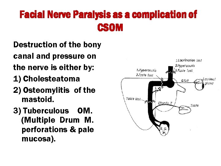 Facial Nerve Paralysis as a complication of CSOM Destruction of the bony canal and