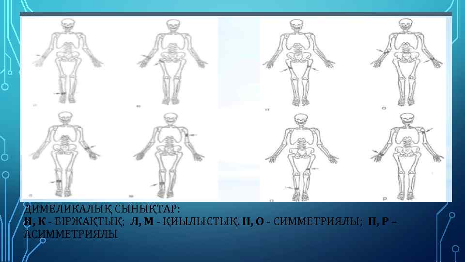 ДИМЕЛИКАЛЫҚ СЫНЫҚТАР: И, К - БІРЖАҚТЫҚ; Л, М - ҚИЫЛЫСТЫҚ. Н, О - СИММЕТРИЯЛЫ;