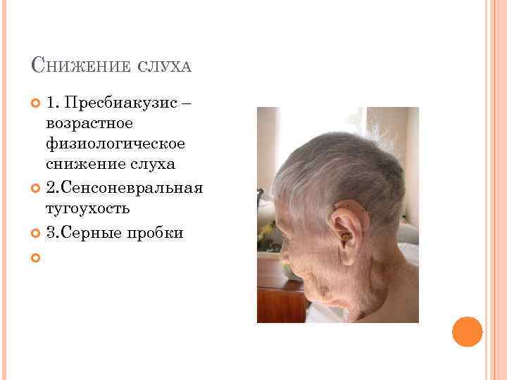 СНИЖЕНИЕ СЛУХА 1. Пресбиакузис – возрастное физиологическое снижение слуха 2. Сенсоневральная тугоухость 3. Серные