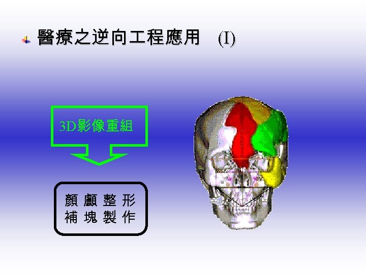  醫療之逆向 程應用 3 D影像重組 顏 顱 整 形 補 塊 製 作 (Ⅰ)