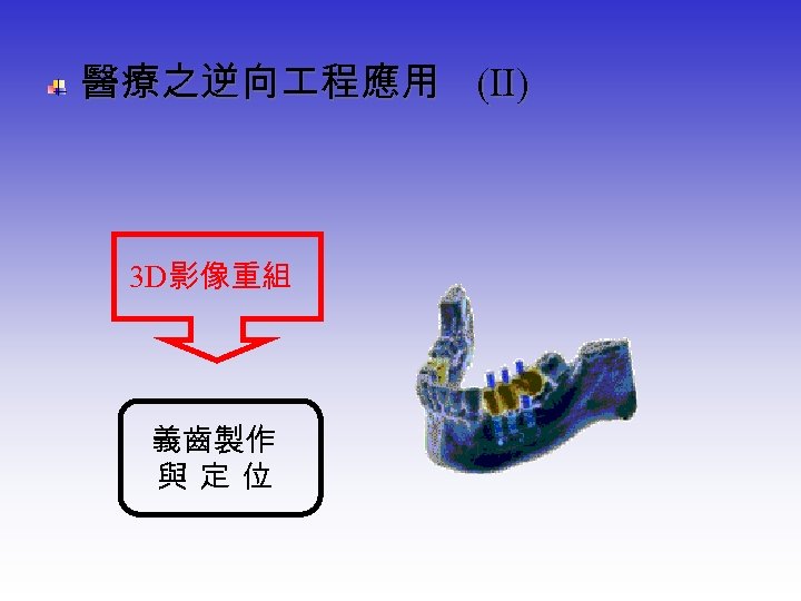  醫療之逆向 程應用 3 D影像重組 義齒製作 與 定 位 (Ⅱ) 