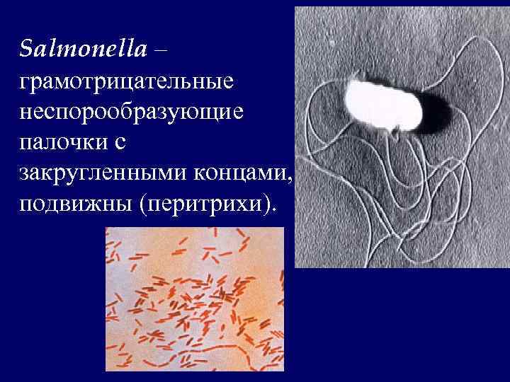 Salmonella – грамотрицательные неспорообразующие палочки с закругленными концами, подвижны (перитрихи). 