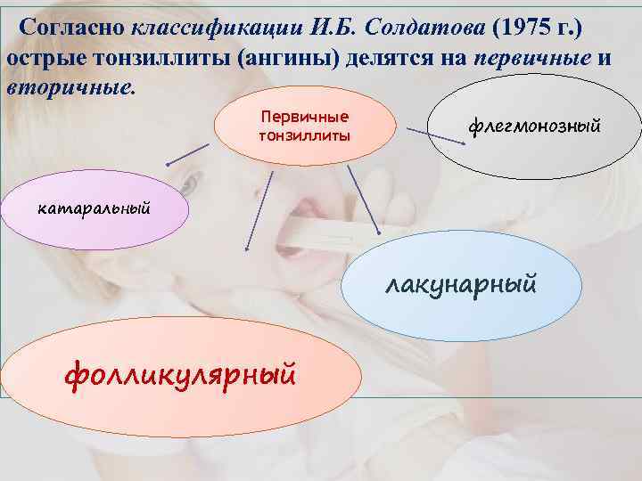 Согласно классификации И. Б. Солдатова (1975 г. ) острые тонзиллиты (ангины) делятся на первичные