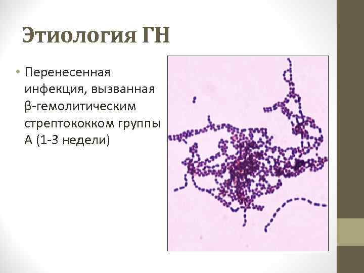 Этиология ГН • Перенесенная инфекция, вызванная β-гемолитическим стрептококком группы А (1 -3 недели) 