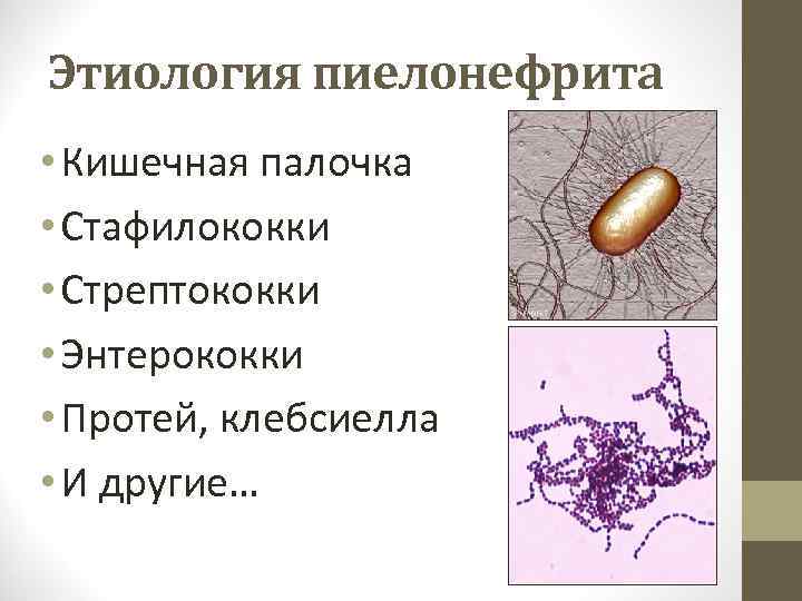 Этиология пиелонефрита • Кишечная палочка • Стафилококки • Стрептококки • Энтерококки • Протей, клебсиелла