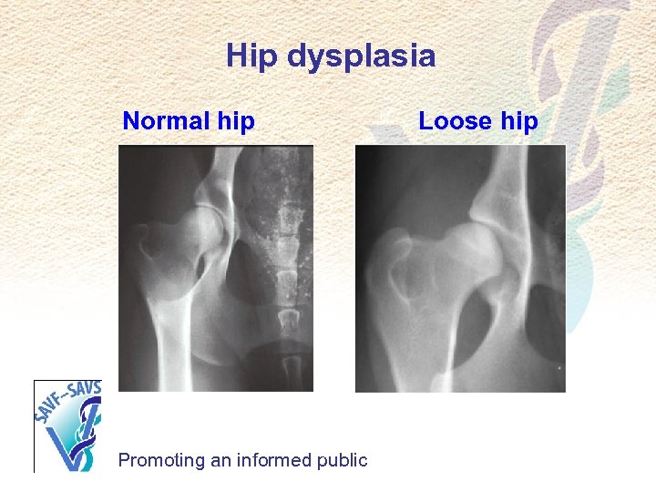 Hip dysplasia Normal hip Promoting an informed public Loose hip 