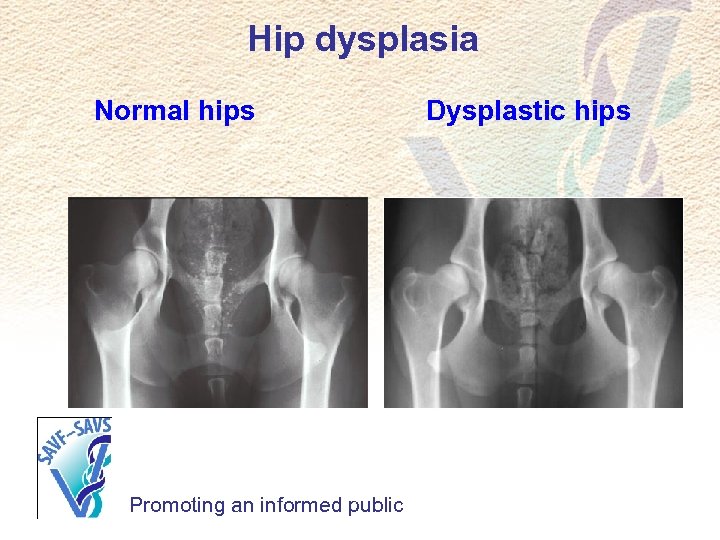 Hip dysplasia Normal hips Promoting an informed public Dysplastic hips 