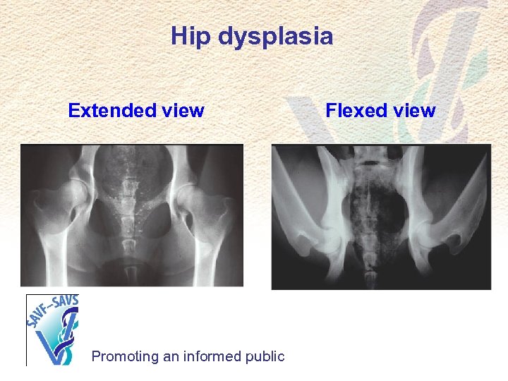 Hip dysplasia Extended view Promoting an informed public Flexed view 