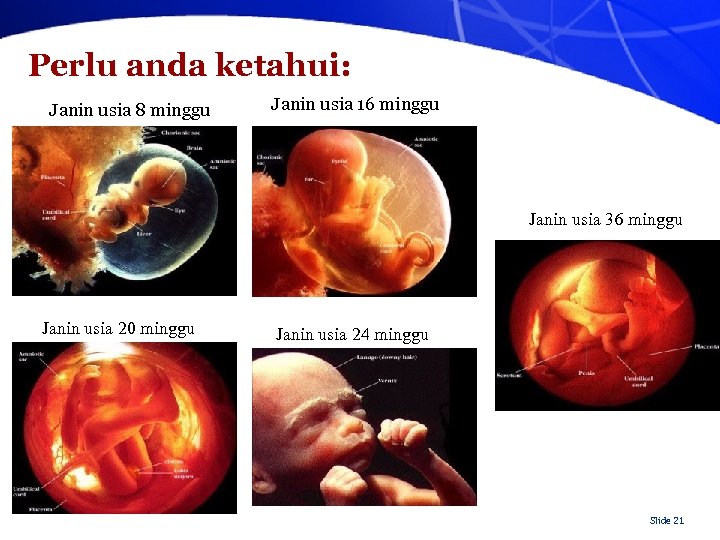 Perlu anda ketahui: Janin usia 8 minggu Janin usia 16 minggu Janin usia 36