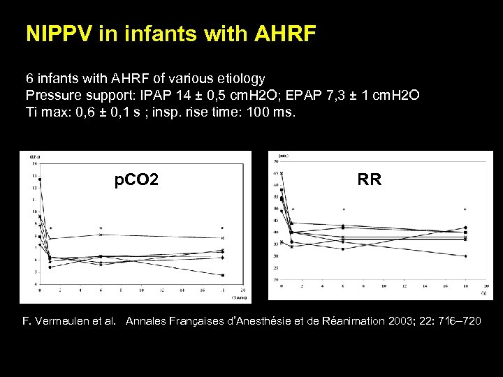 NIPPV in infants with AHRF 6 infants with AHRF of various etiology Pressure support: