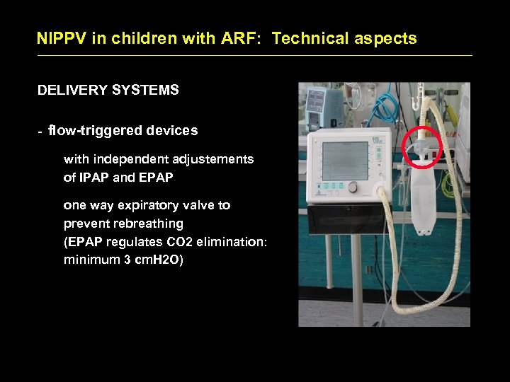 NIPPV in children with ARF: Technical aspects DELIVERY SYSTEMS - flow-triggered devices with independent