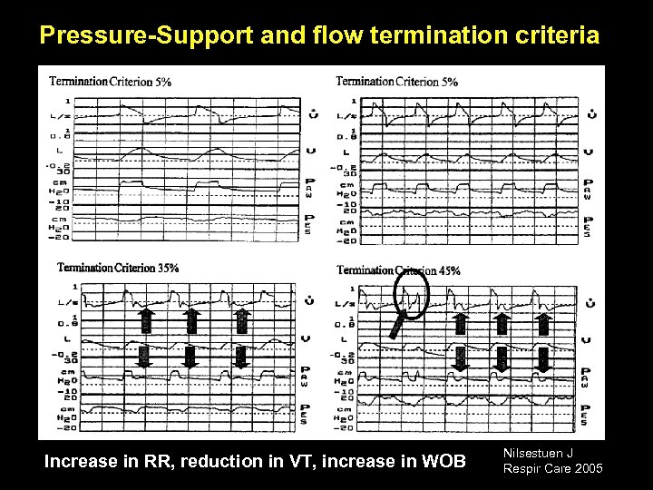 Pressure-Support and flow termination criteria Increase in RR, reduction in VT, increase in WOB