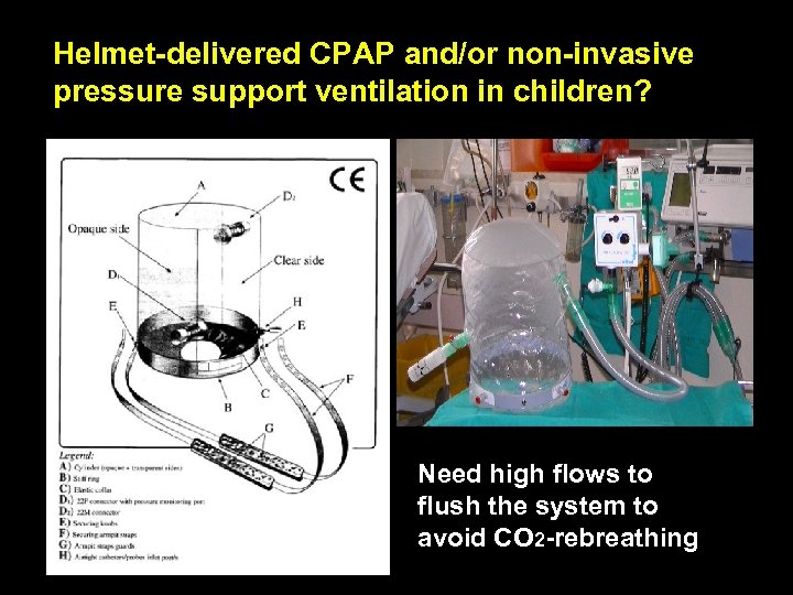 Helmet-delivered CPAP and/or non-invasive pressure support ventilation in children? Need high flows to flush