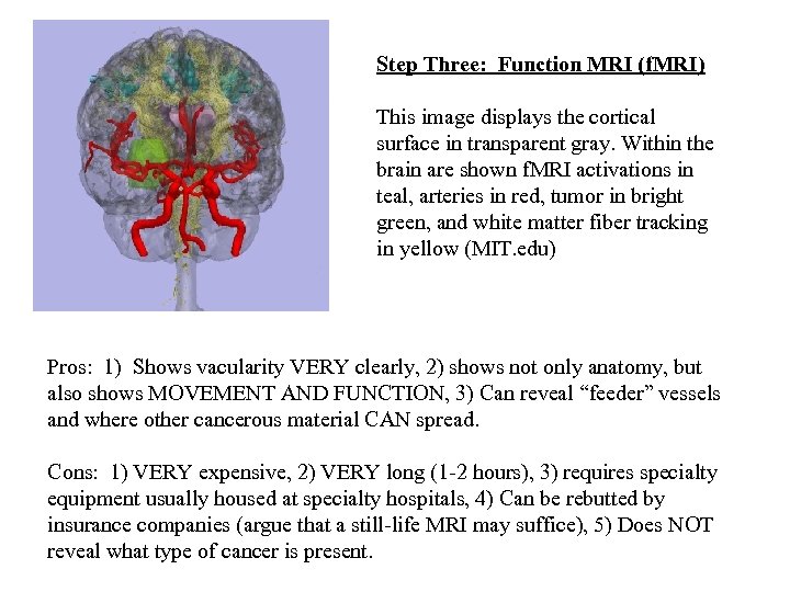  Step Three: Function MRI (f. MRI) This image displays the cortical surface in
