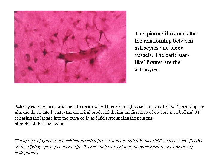 This picture illustrates the relationship between astrocytes and blood vessels. The dark 'starlike' figures