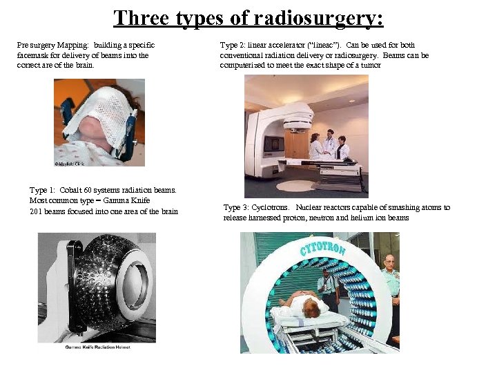 Three types of radiosurgery: Pre surgery Mapping: building a specific facemask for delivery of