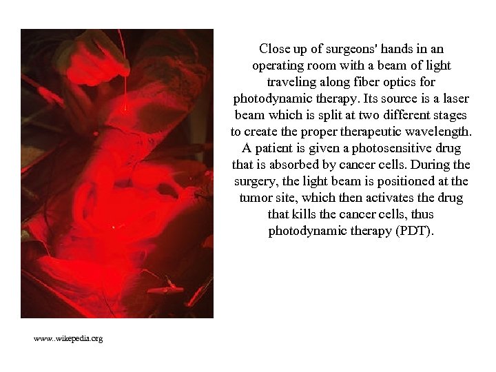 Close up of surgeons' hands in an operating room with a beam of light